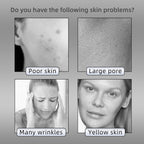 LED Therapy Face Mask